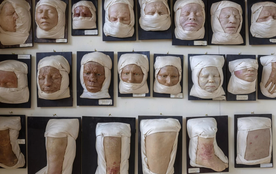 A wall with a collection of moulages showing models of faces, legs and backs
